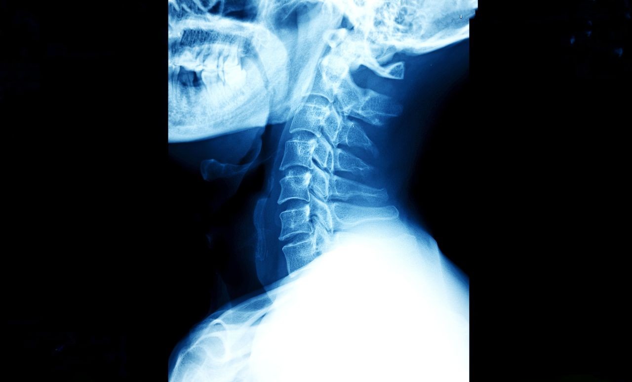 x-ray-image-of-human-neck-2026-01-07-06-59-02-utc-1